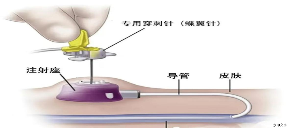 5f9628bbbf844e25b929230e767c13de.png