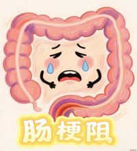 什么是肠梗阻？一文读懂这个“肠”见急症