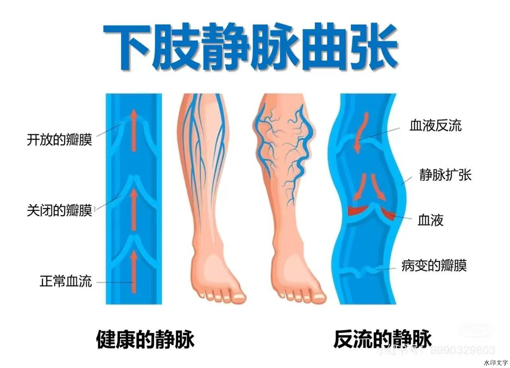 bac65c6c9cb14cd686bce1dbf0e3bd53.png