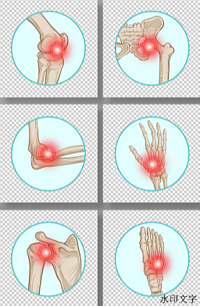 关于骨关节炎的预防调摄