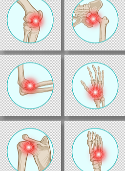 关于骨关节炎的预防调摄