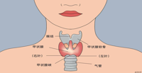 甲状腺结节——“真”气出来的病