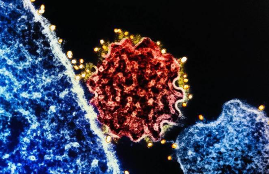 尼帕病毒：一种不容忽视的新发传染病