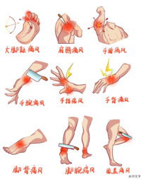 新年吃吃又喝喝，痛风可别“凑热闹”