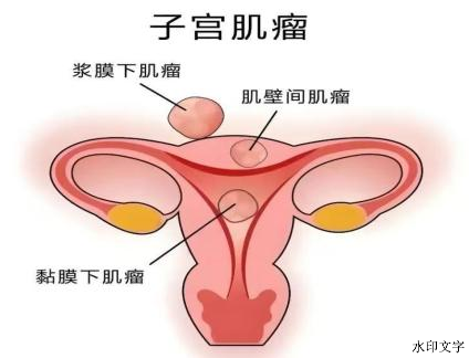 b26d2cc57c2c4692a8cbe8aea1e758b4.png