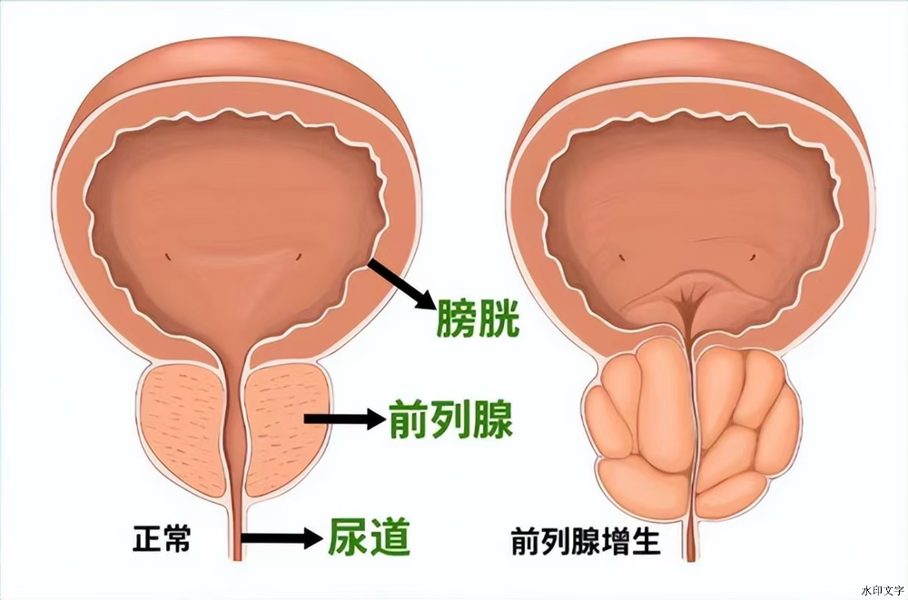 1b61c7b595d5452884643a8ba78b6050.png 1b61c7b595d5452884643a8ba78b6050.png