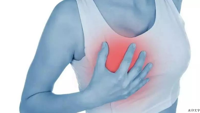 乳头瘙痒，是皮肤在“撒娇”还是身体在“报警”？