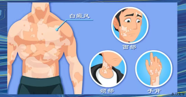 5f57cb0f0a144368842c8e79fa630732.png
