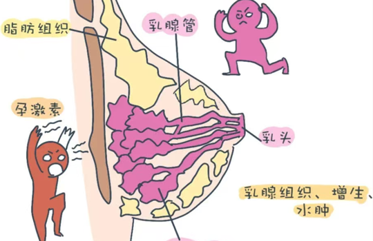 乳房里的“小疙瘩”别慌张，科学认识乳腺结节与增生