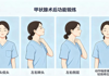 甲状腺术后颈肩功能锻炼全攻略